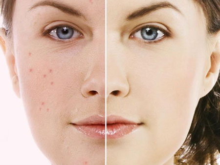 medbeautycare prosopo14