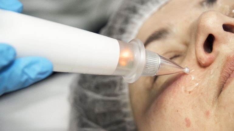 medbeautycare prosopo15
