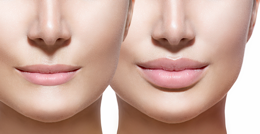 medbeautycare prosopo16