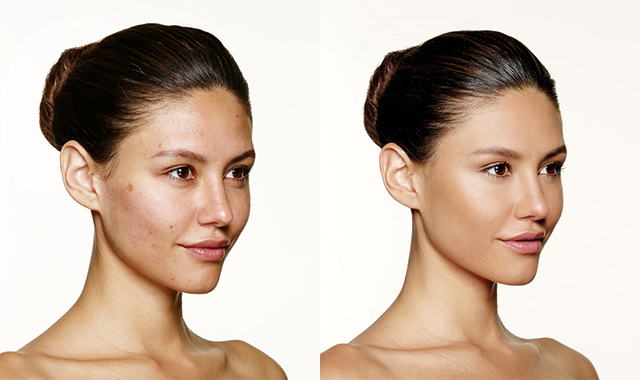 medbeautycare prosopo19