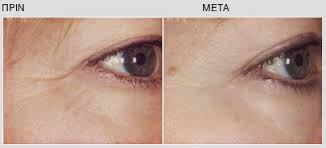 medbeautycare prosopo5